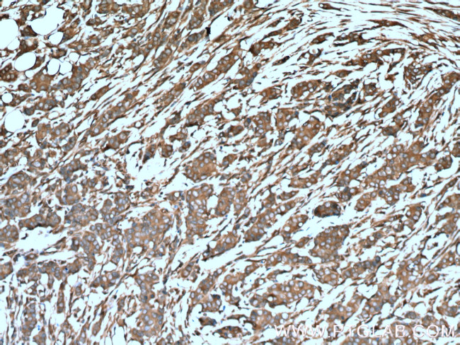 ARF4 Antibody in Immunohistochemistry (Paraffin) (IHC (P))