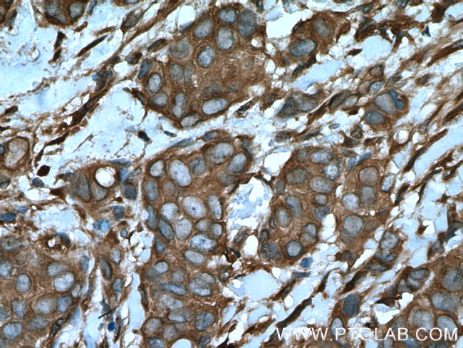 ARF4 Antibody in Immunohistochemistry (Paraffin) (IHC (P))