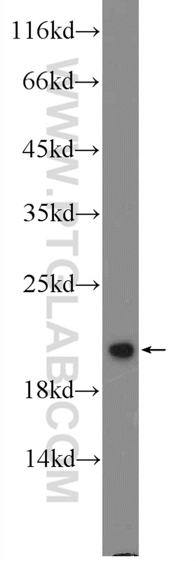 ARF4 Antibody in Western Blot (WB)