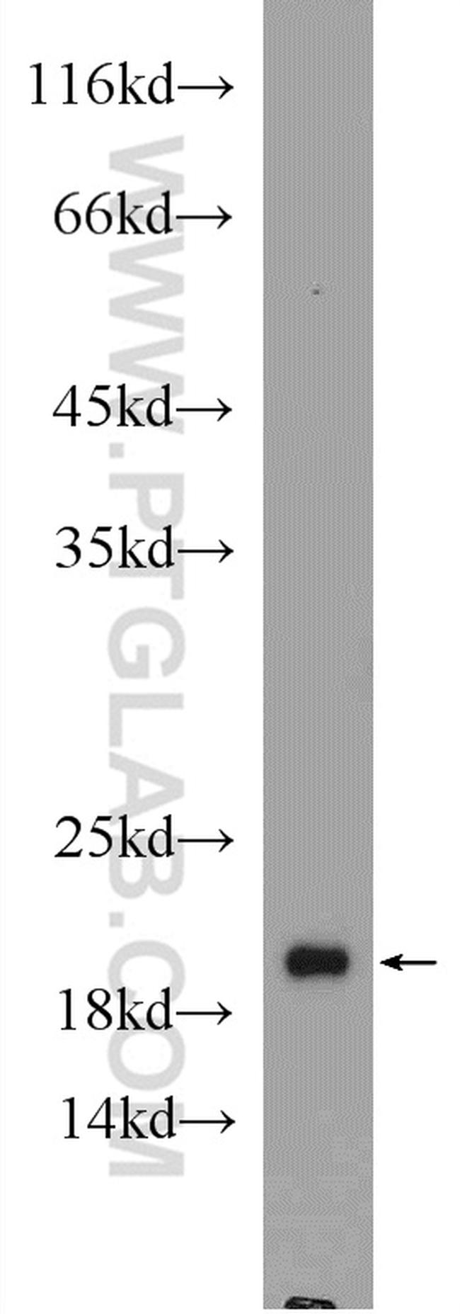 ARF4 Antibody in Western Blot (WB)