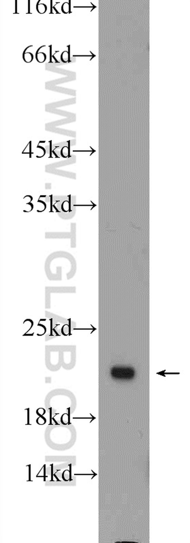 ARF4 Antibody in Western Blot (WB)