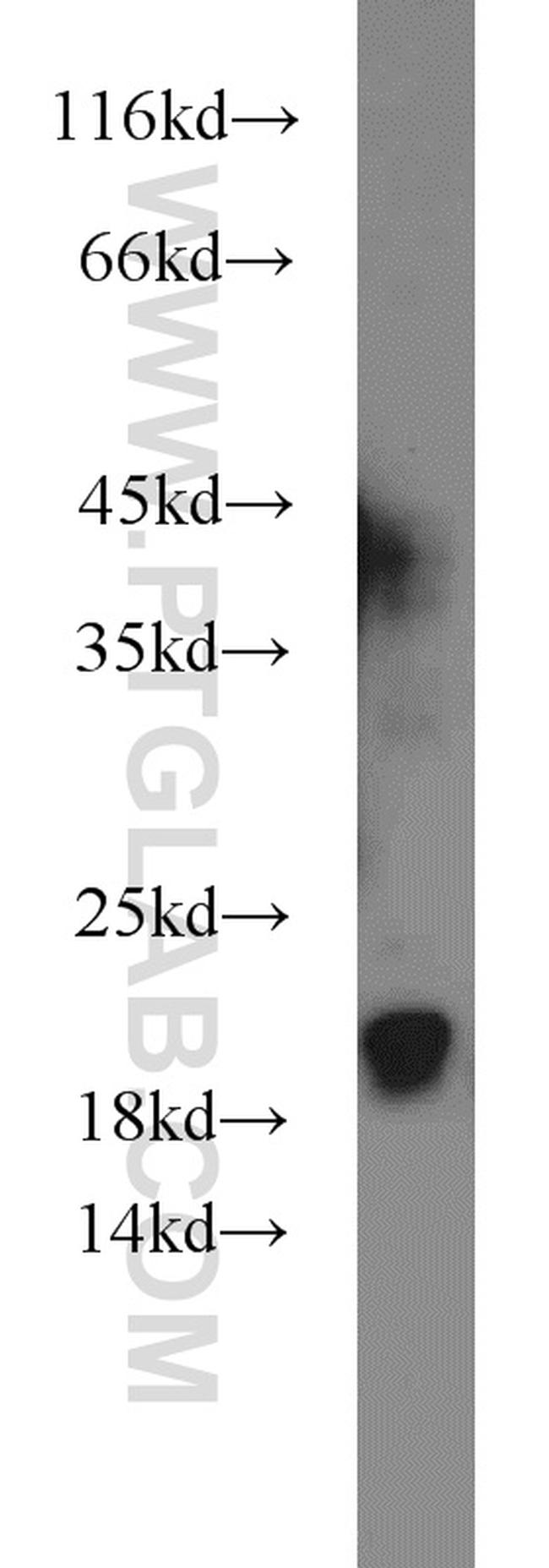 ARPP-19 Antibody in Western Blot (WB)
