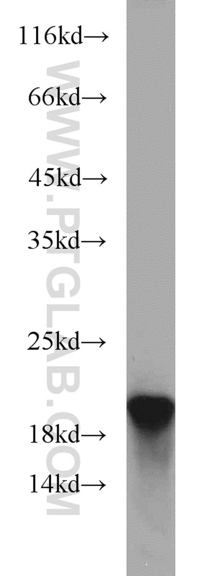 ARPP-19 Antibody in Western Blot (WB)