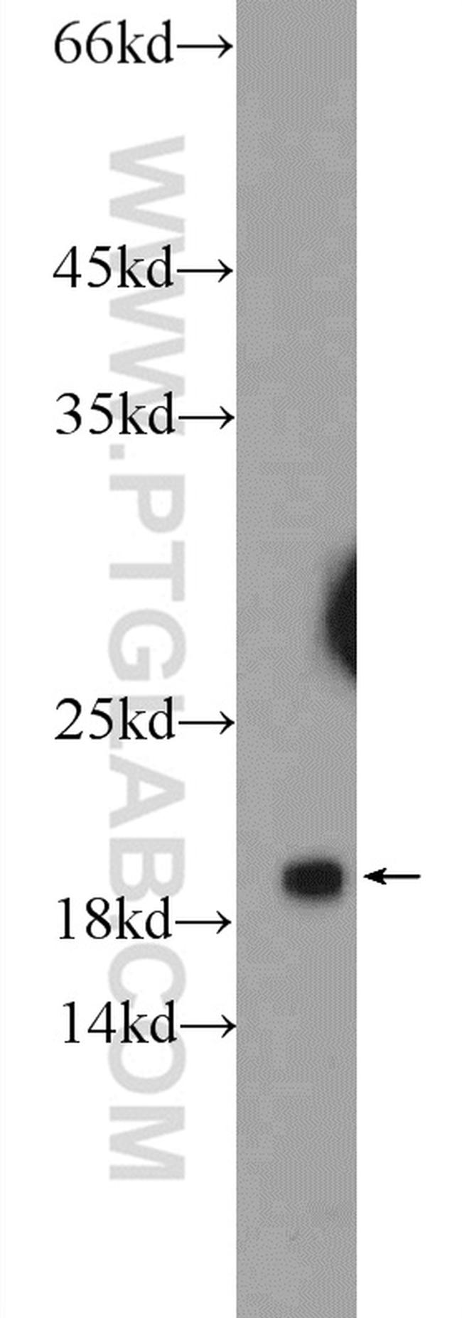 ARPP-19 Antibody in Western Blot (WB)