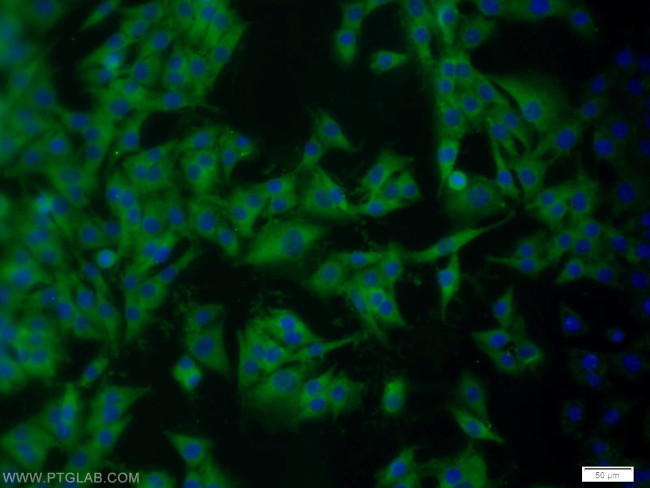 ARPP-19 Antibody in Immunocytochemistry (ICC/IF)