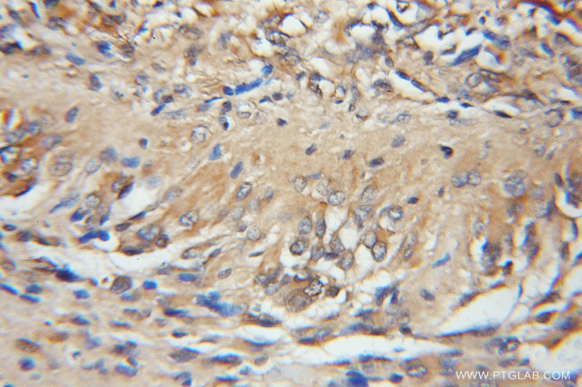 ARPP-19 Antibody in Immunohistochemistry (Paraffin) (IHC (P))