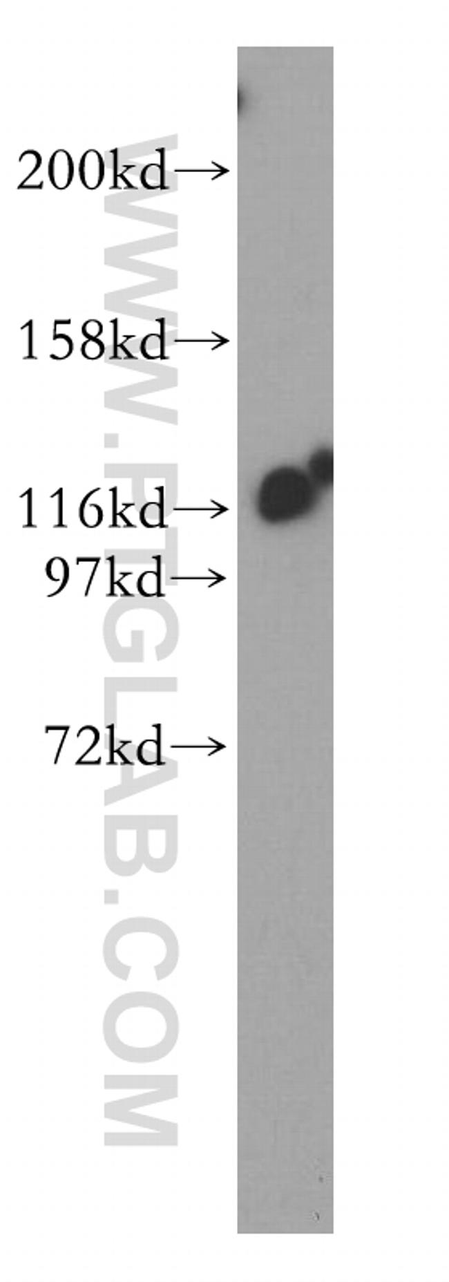 IPO4 Antibody in Western Blot (WB)