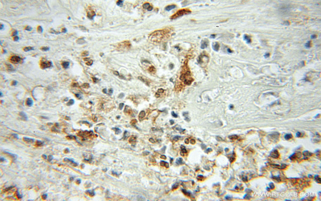 Profilin 1 Antibody in Immunohistochemistry (Paraffin) (IHC (P))