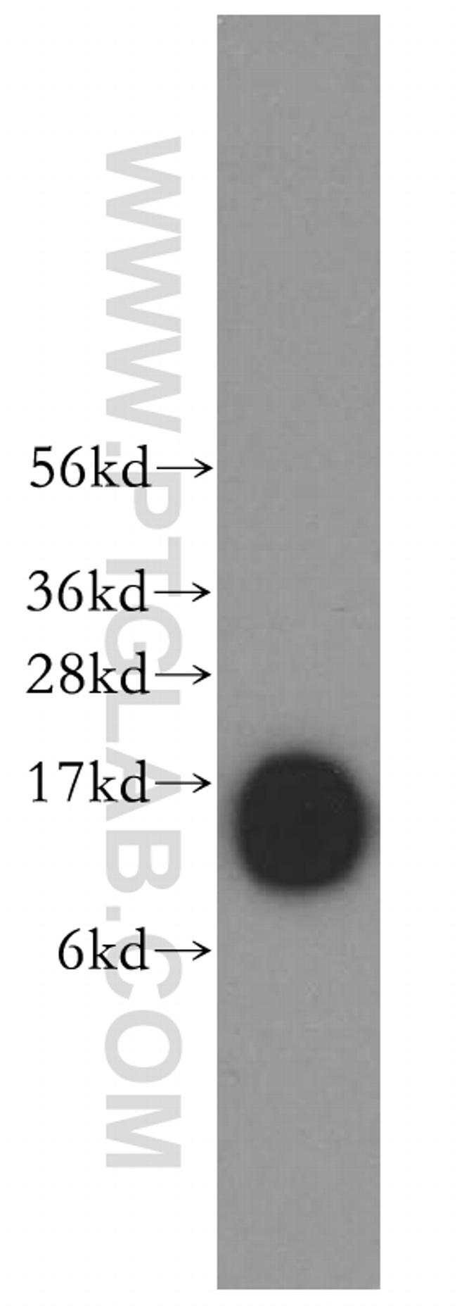 Profilin 1 Antibody in Western Blot (WB)