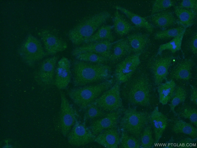 PARK7/DJ-1 Antibody in Immunocytochemistry (ICC/IF)