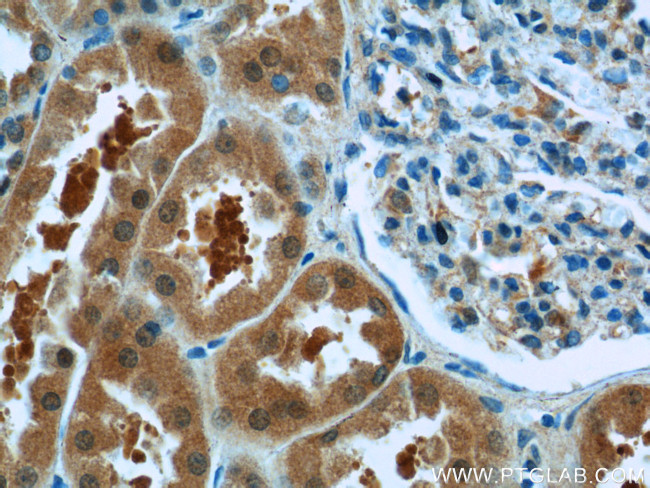 PARK7/DJ-1 Antibody in Immunohistochemistry (Paraffin) (IHC (P))