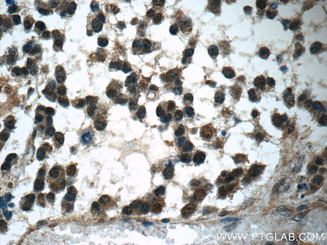 PARK7/DJ-1 Antibody in Immunohistochemistry (Paraffin) (IHC (P))