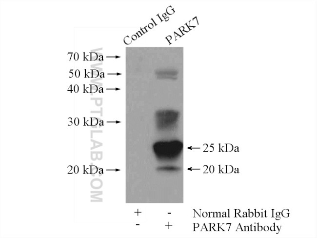 PARK7/DJ-1 Antibody in Immunoprecipitation (IP)