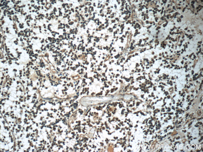 PARK7/DJ-1 Antibody in Immunohistochemistry (Paraffin) (IHC (P))