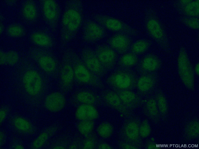 PSMB6 Antibody in Immunocytochemistry (ICC/IF)