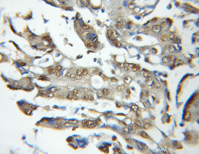 PSMB6 Antibody in Immunohistochemistry (Paraffin) (IHC (P))