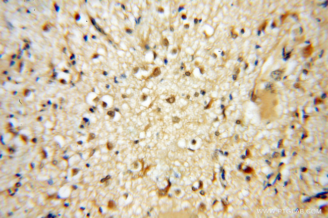 PSMB6 Antibody in Immunohistochemistry (Paraffin) (IHC (P))