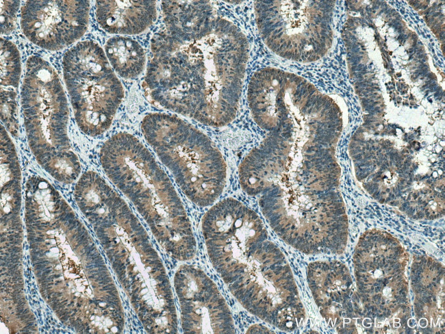 PSMB6 Antibody in Immunohistochemistry (Paraffin) (IHC (P))