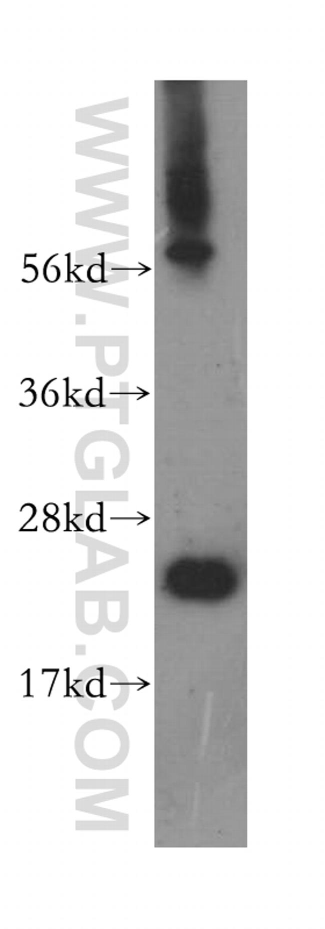 PSMB6 Antibody in Western Blot (WB)