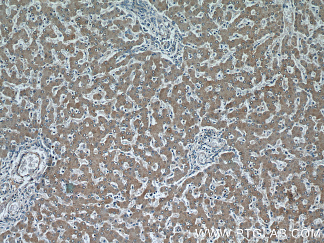 CYP4A11 Antibody in Immunohistochemistry (Paraffin) (IHC (P))