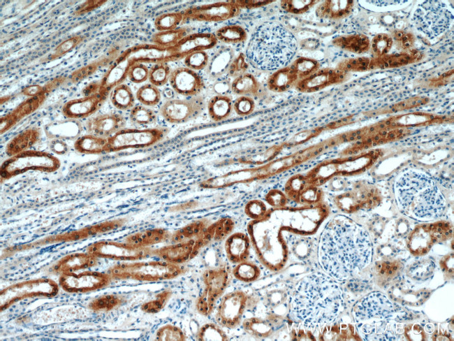 CYP4A11 Antibody in Immunohistochemistry (Paraffin) (IHC (P))