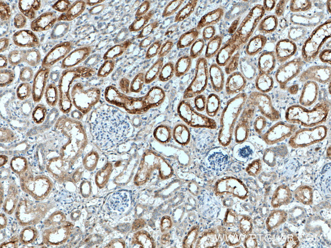 CYP4A11 Antibody in Immunohistochemistry (Paraffin) (IHC (P))