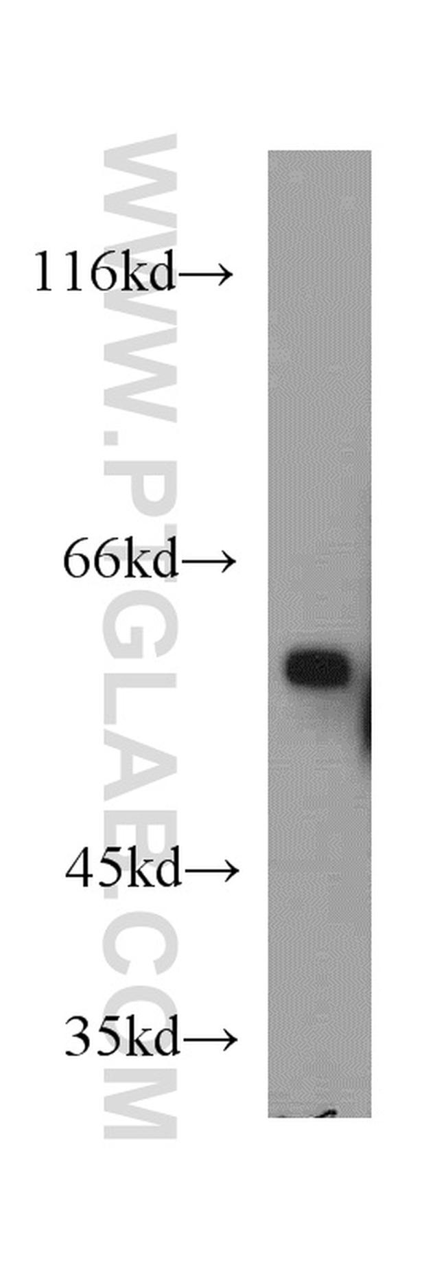 CYP4A11 Antibody in Western Blot (WB)