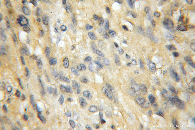 EXOC1 Antibody in Immunohistochemistry (Paraffin) (IHC (P))