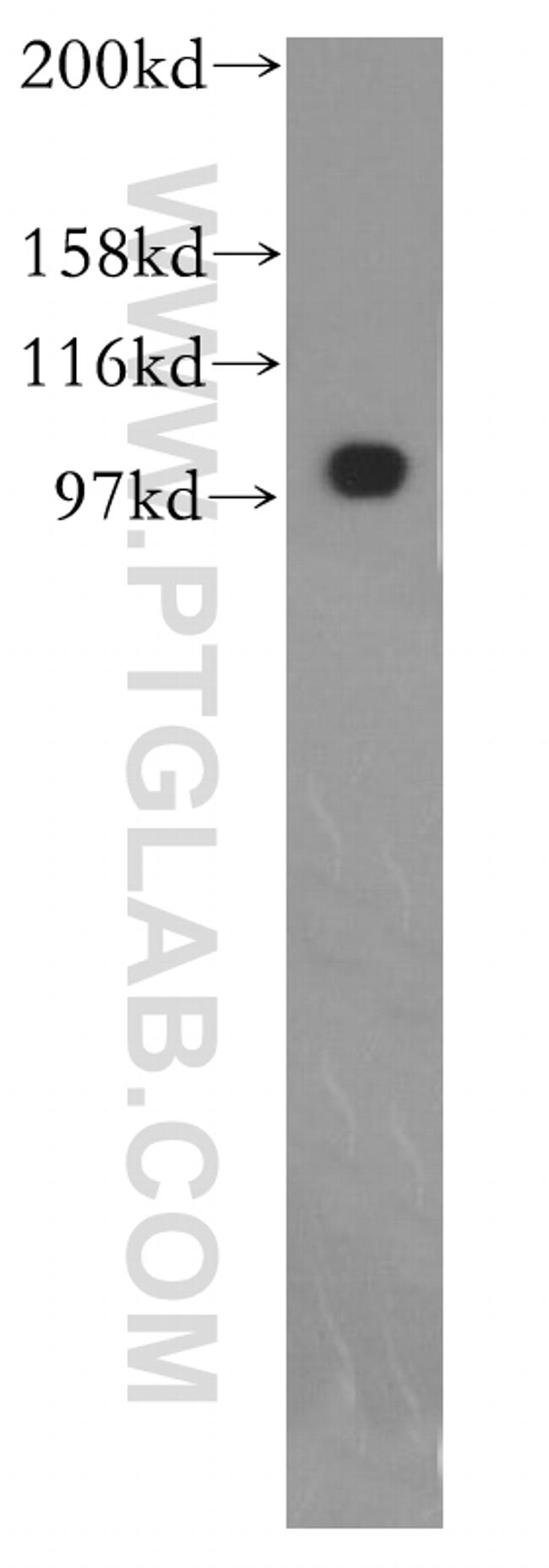 EXOC1 Antibody in Western Blot (WB)