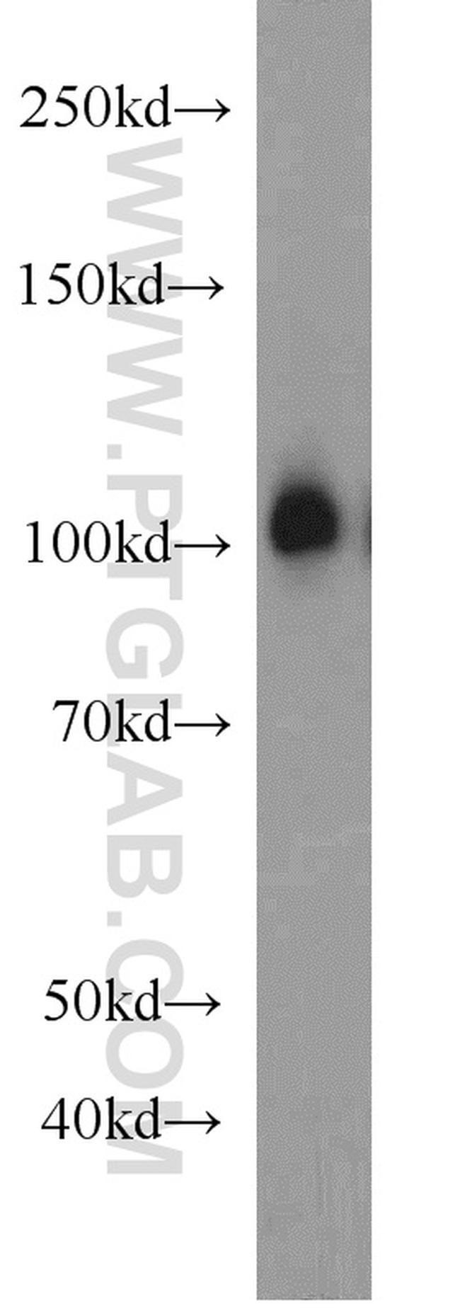 EXOC1 Antibody in Western Blot (WB)