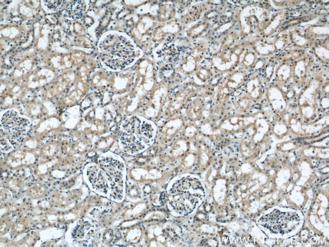 TAX1BP3 Antibody in Immunohistochemistry (Paraffin) (IHC (P))