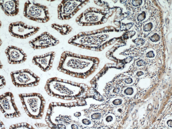 TAX1BP3 Antibody in Immunohistochemistry (Paraffin) (IHC (P))