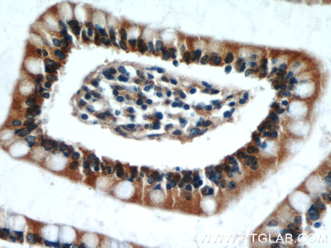 TAX1BP3 Antibody in Immunohistochemistry (Paraffin) (IHC (P))