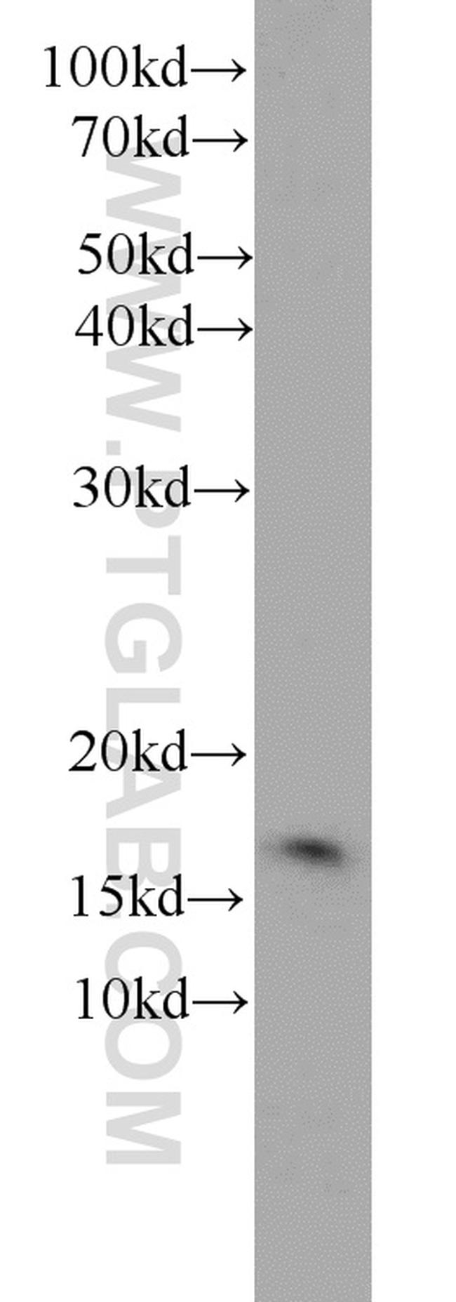 TAX1BP3 Antibody in Western Blot (WB)