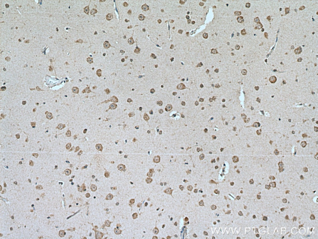 IPO13 Antibody in Immunohistochemistry (Paraffin) (IHC (P))