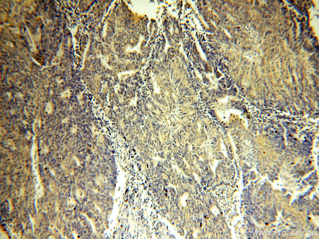 IPO13 Antibody in Immunohistochemistry (Paraffin) (IHC (P))