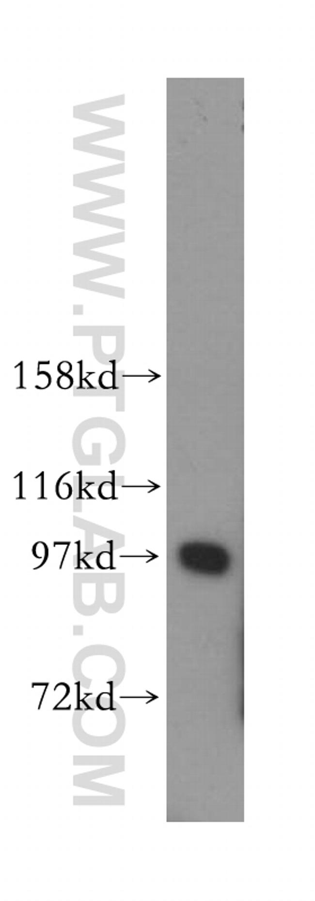 IPO13 Antibody in Western Blot (WB)