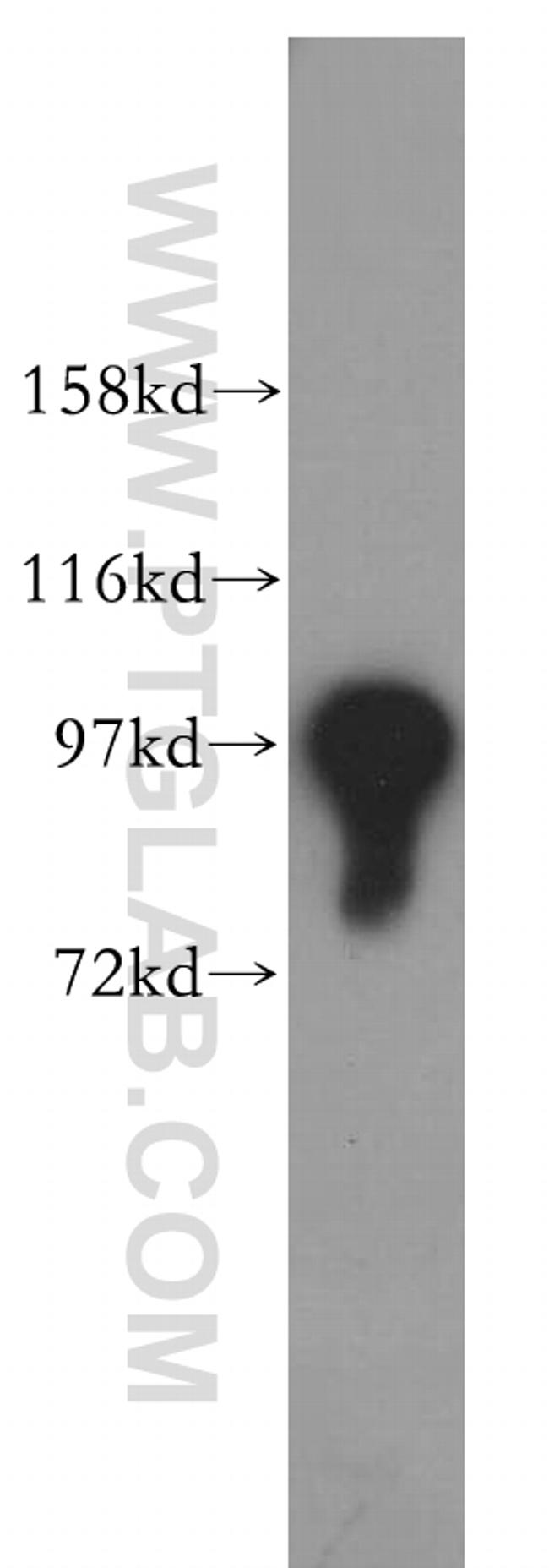 IPO13 Antibody in Western Blot (WB)