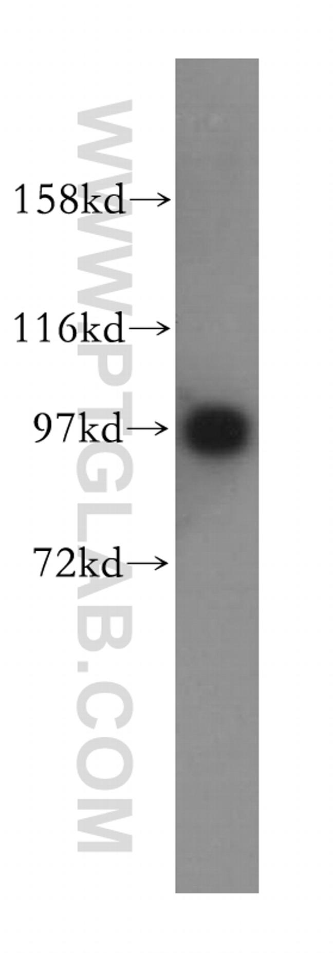 IPO13 Antibody in Western Blot (WB)