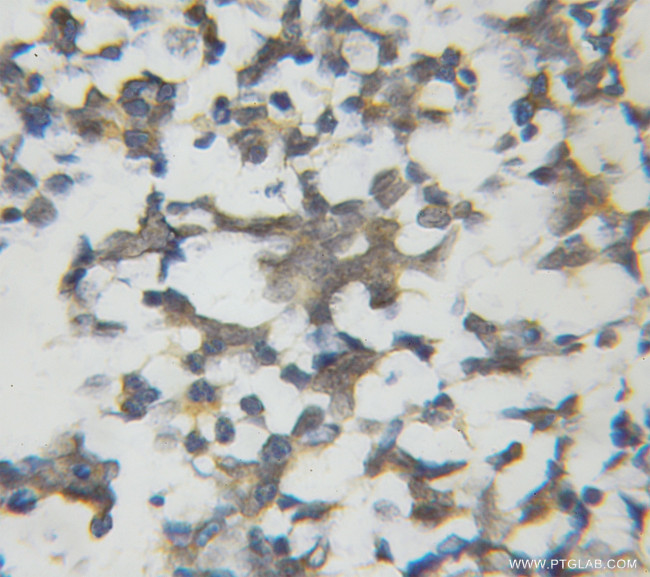 IPO13 Antibody in Immunohistochemistry (Paraffin) (IHC (P))