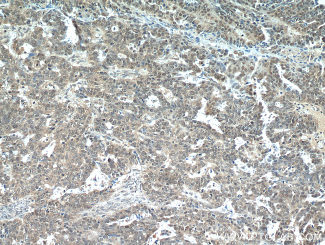 MLH1 Antibody in Immunohistochemistry (Paraffin) (IHC (P))