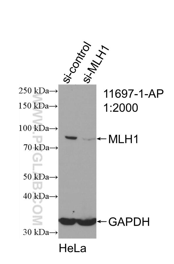 MLH1 Antibody in Western Blot (WB)