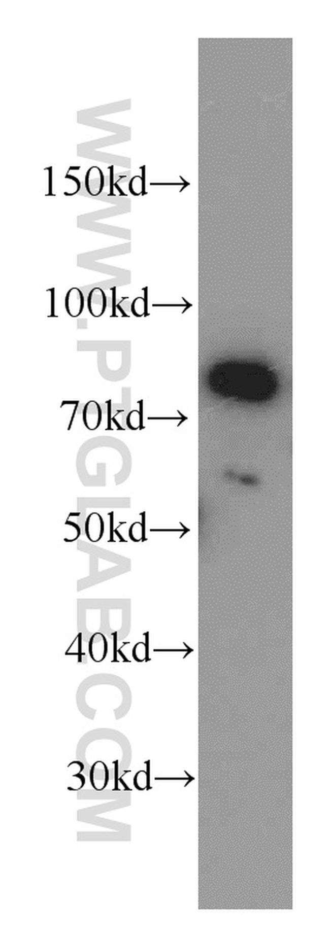 MLH1 Antibody in Western Blot (WB)