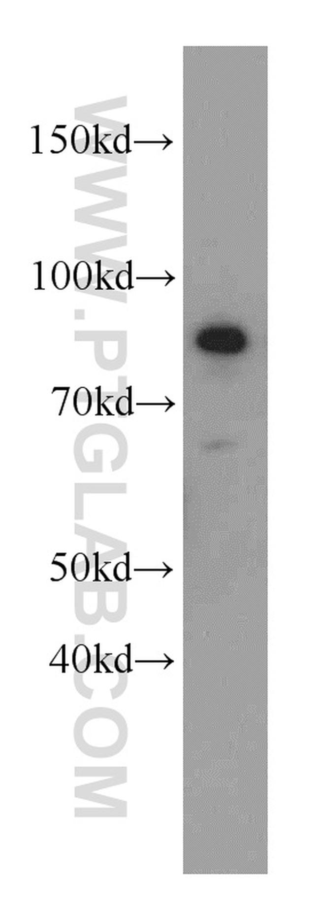 MLH1 Antibody in Western Blot (WB)