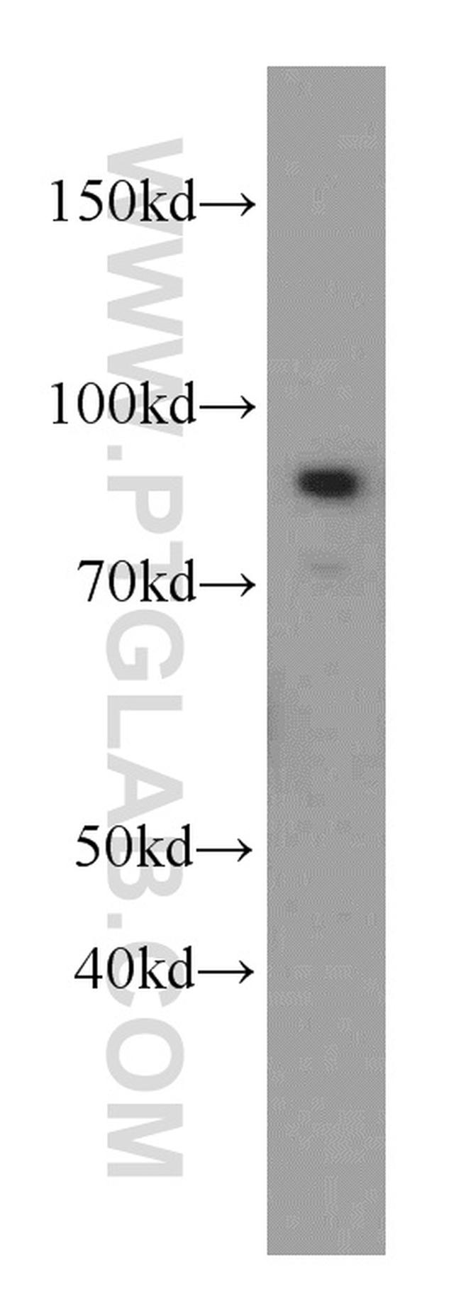 MLH1 Antibody in Western Blot (WB)