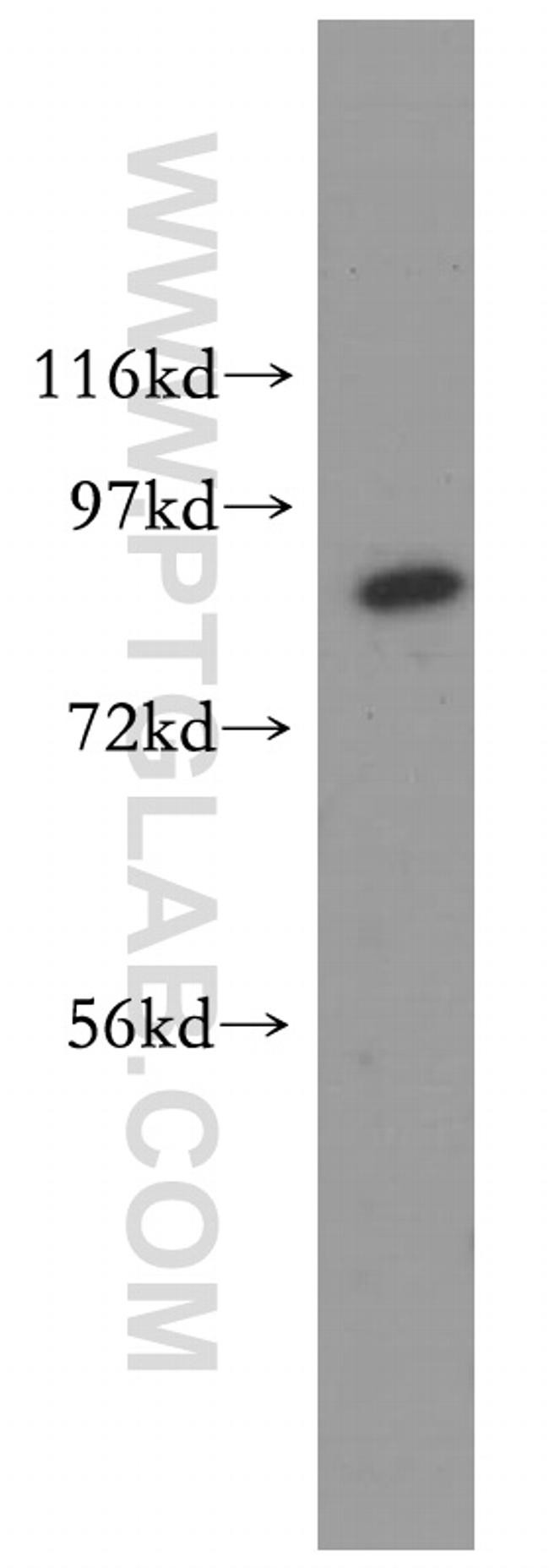 MLH1 Antibody in Western Blot (WB)