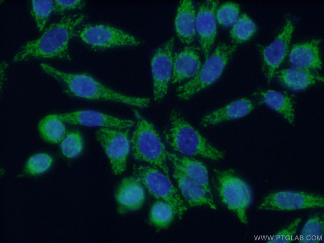 TSFM Antibody in Immunocytochemistry (ICC/IF)