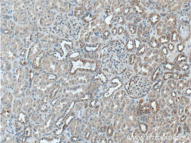 TSFM Antibody in Immunohistochemistry (Paraffin) (IHC (P))