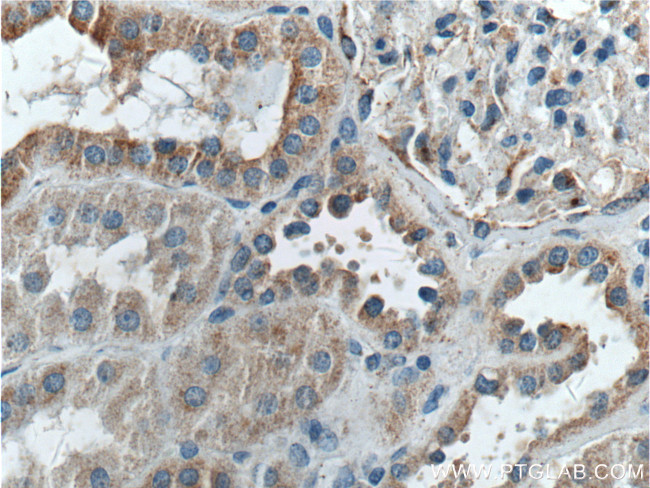 TSFM Antibody in Immunohistochemistry (Paraffin) (IHC (P))