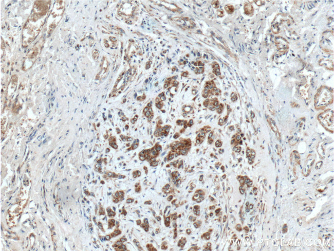 TSFM Antibody in Immunohistochemistry (Paraffin) (IHC (P))